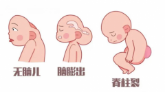 内江市妇幼保健院产科医生指出：孕期科学增补叶酸可预防出生缺陷！